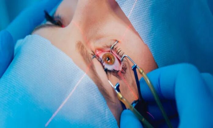 Lasik Surgery