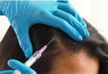 PRP Hair Treatment – Expert Skin Care Clinic in Bangalore PRP treatment