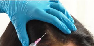 PRP Hair Treatment – Expert Skin Care Clinic in Bangalore PRP treatment